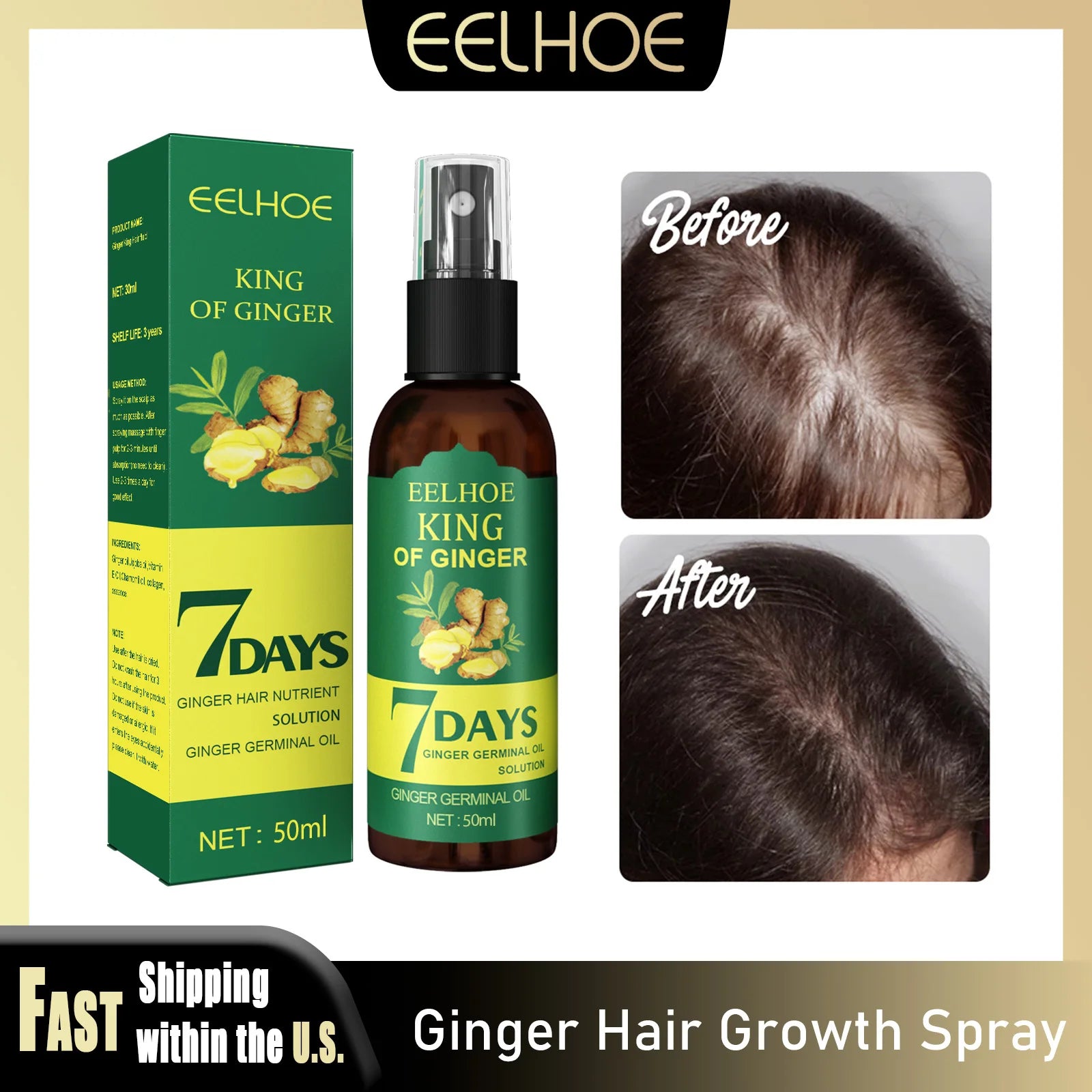 Ginger Hair Growth Spray Natural Ingredients Nutrition Increase Hair Scalp Repair Oil