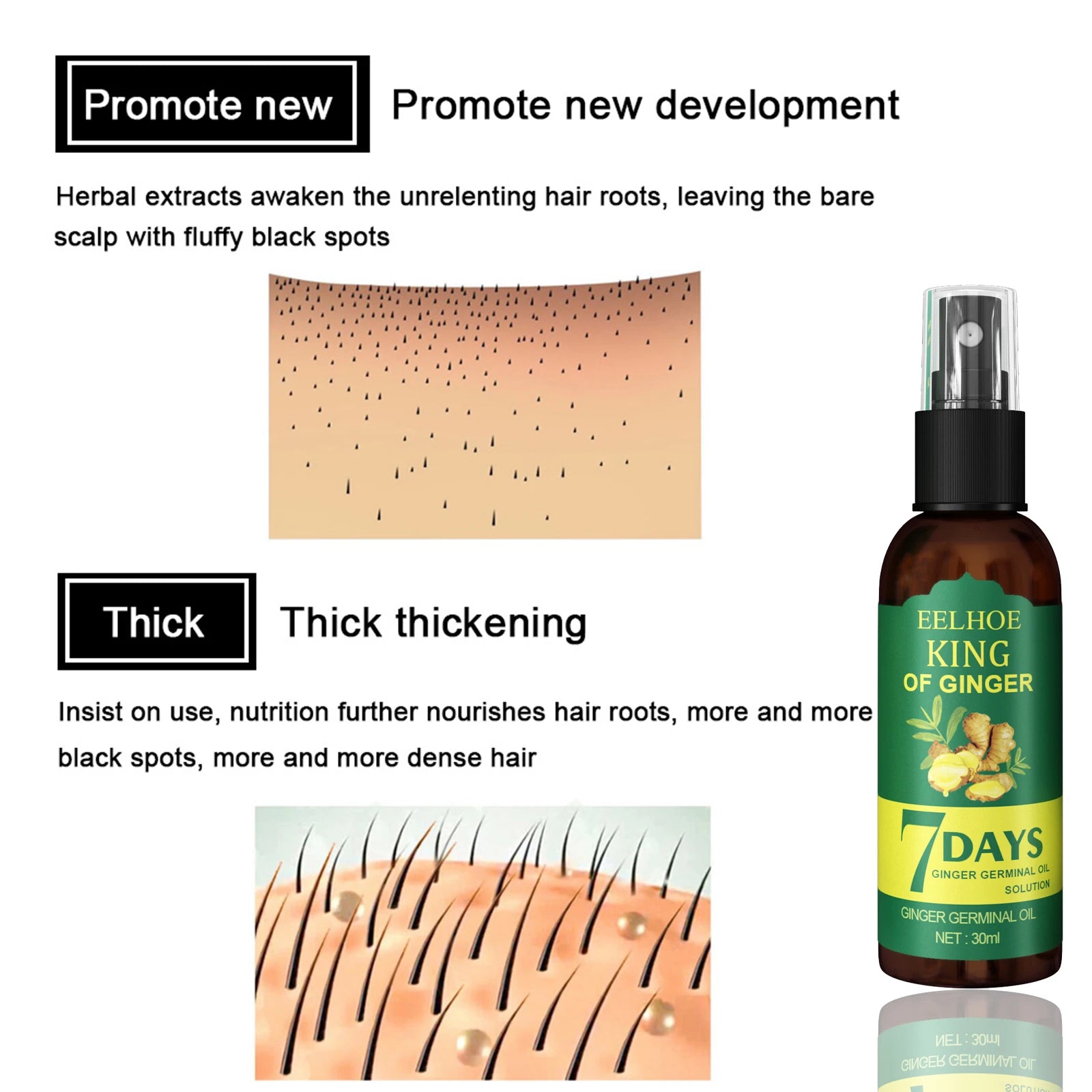 Ginger Hair Growth Spray Natural Ingredients Nutrition Increase Hair Scalp Repair Oil