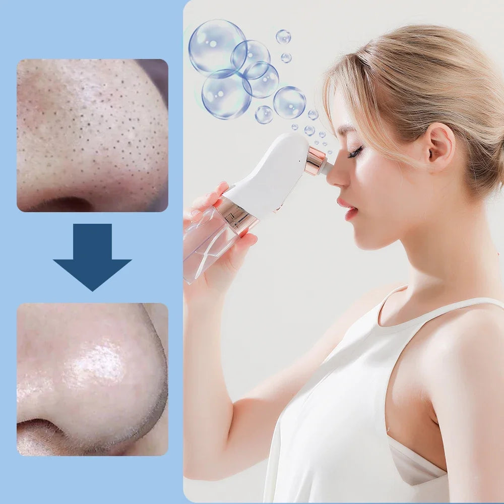 Small Bubble Facial Blackhead Removal Vacuum Face Cleaner