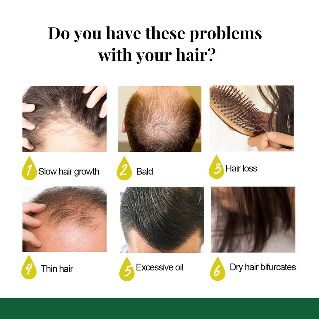 Ginger Hair Growth Spray Natural Ingredients Nutrition Increase Hair Scalp Repair Oil