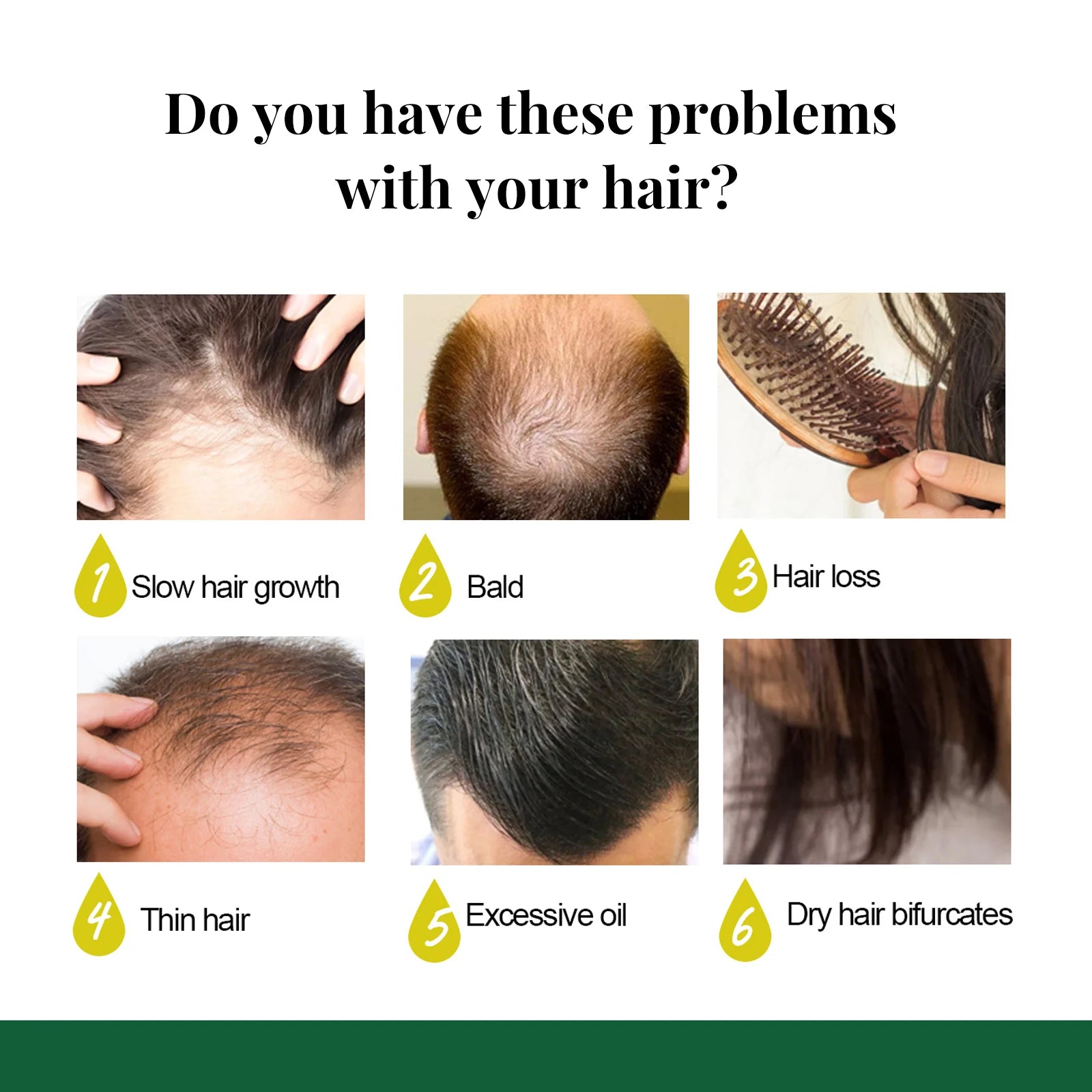 Ginger Hair Growth Spray Natural Ingredients Nutrition Increase Hair Scalp Repair Oil